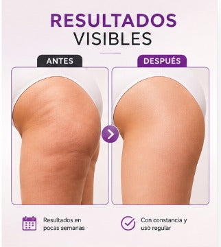 BodySculpt - MASAJEADOR ANTICELULITICO